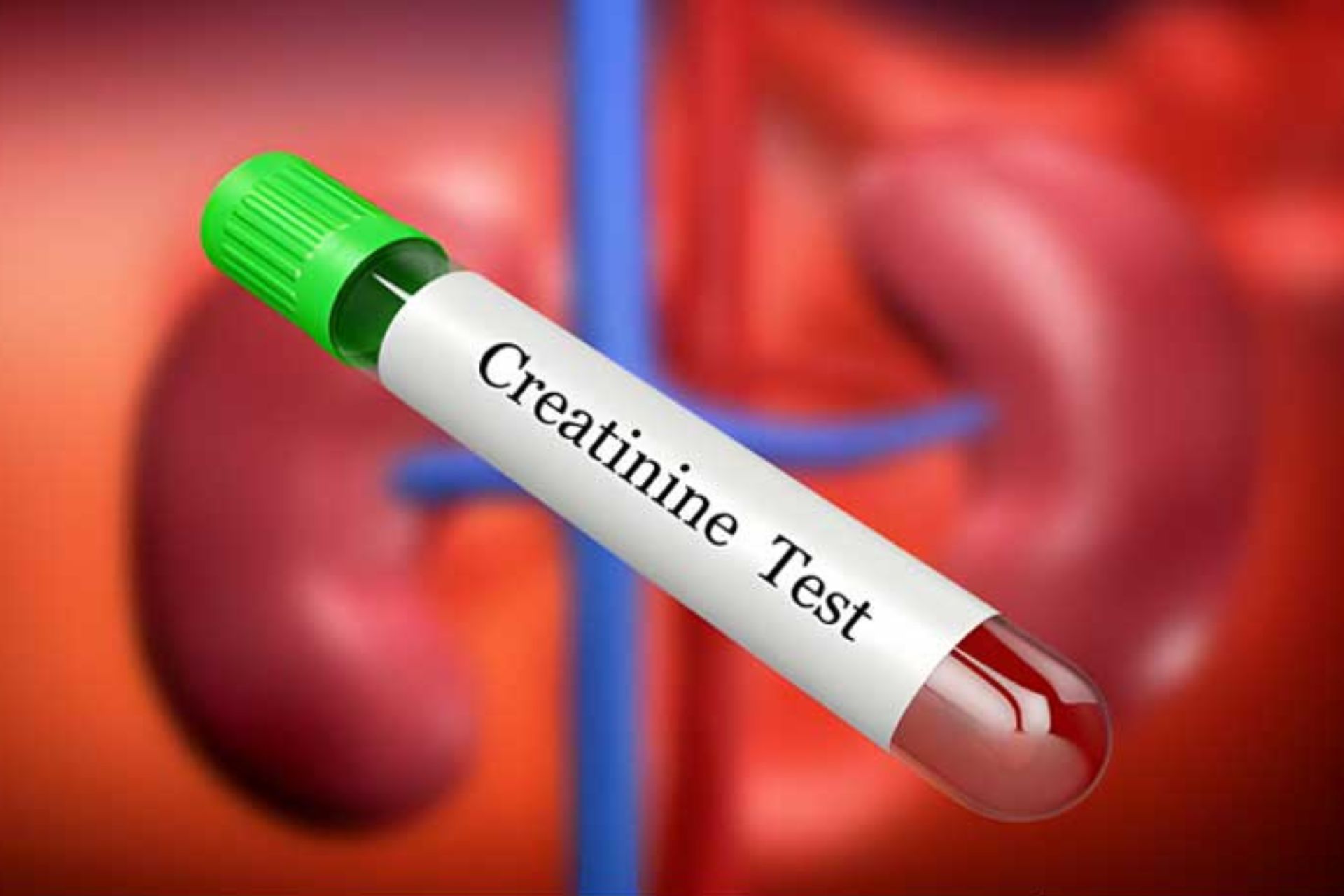 S.creatinine test price in Bangladesh